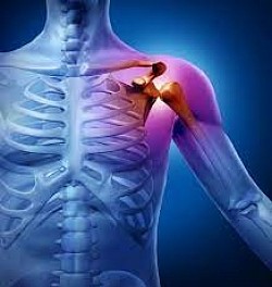 We prevent surgery by using a projected light for instant healing
