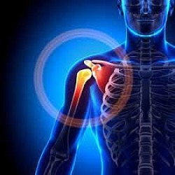 We can treat arthritis so quickly than ever.
